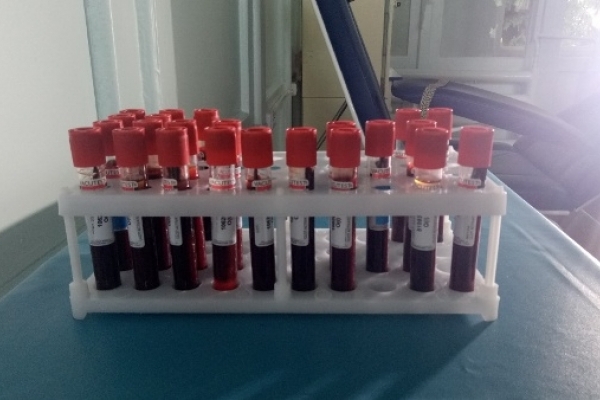 Екскурсію «шляхом донора» провели журналістам у Рівненській обласній станції переливання крові 