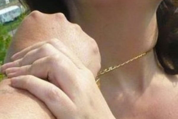 У Рівному поліцейські затримали зловмисника, який пограбував жінку посеред білого дня 