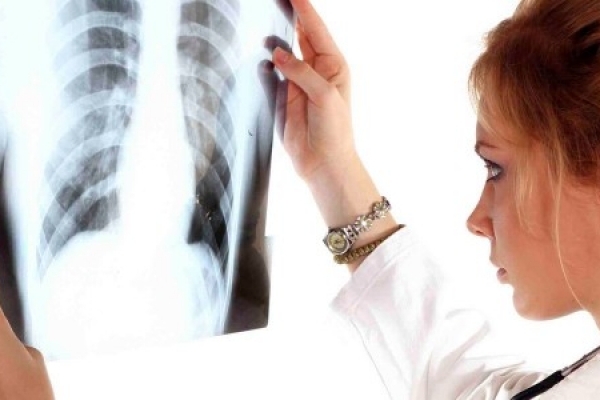 Дві дитини із 5-ти хворих на туберкульоз на Рівненщині мали заразну форму