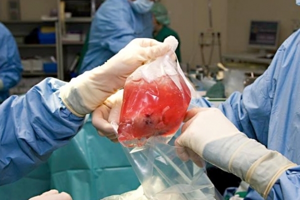 Верховна Рада України ухвалила закон про трансплантацію органів 