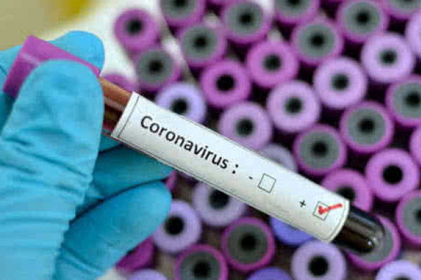 П’ять закладів Рівненщини готуються до прийому хворих із підозрою на коронавірус