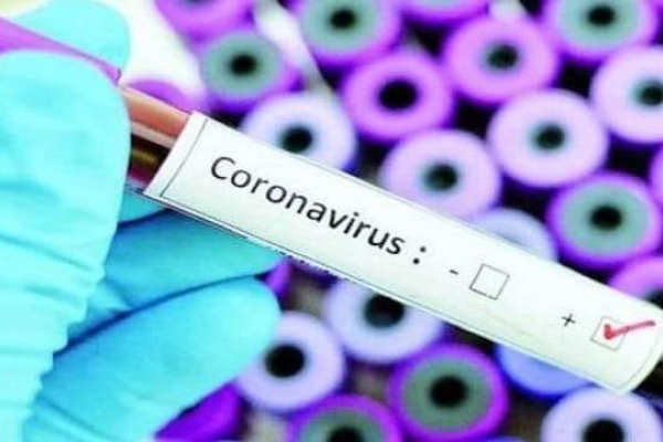 У Бугринській ОТГ зареєстровано два нових випадки коронавірусної інфекції